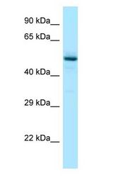 RENBP Antibody - RENBP antibody Western Blot of Fetal Liver.  This image was taken for the unconjugated form of this product. Other forms have not been tested.