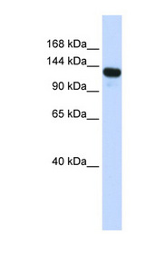RENT1 / UPF1 Antibody - UPF1 antibody Western blot of Transfected 293T cell lysate. This image was taken for the unconjugated form of this product. Other forms have not been tested.
