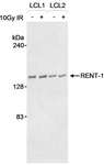 RENT1 / UPF1 Antibody - Detection of Human RENT-1 by Western Blot. Samples: Whole cell lysate (30 ug) from lymphoblastoid cell lines (EBV-immortalized B-cell from a normal individual). Antibody: Affinity purified goat anti-RENT-1 antibody used at 1 ug/ml. Detection: Chemiluminescence.