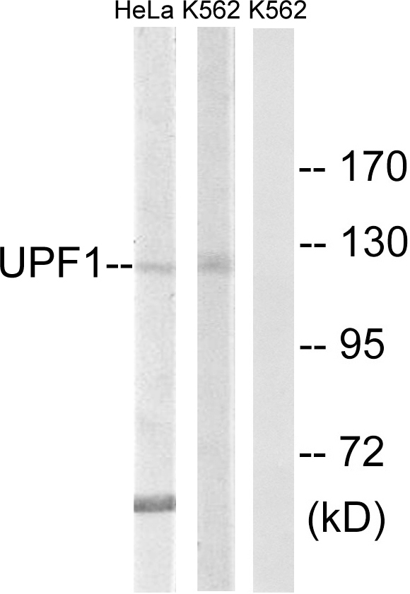 RENT1 / UPF1 Antibody - Western blot analysis of lysates from K562 and HeLa cells, using UPF1 Antibody. The lane on the right is blocked with the synthesized peptide.