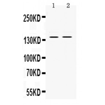 RENT1 / UPF1 Antibody - RENT1/hUPF1 antibody Western blot. All lanes: Anti RENT1/hUPF1 at 0.5 ug/ml. Lane 1: Rat Pancreas Tissue Lysate at 50 ug. Lane 2: PANC Whole Cell Lysate at 40 ug. Predicted band size: 140 kD. Observed band size: 140 kD.