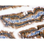 RENT1 / UPF1 Antibody - RENT1/hUPF1 antibody IHC-paraffin. IHC(P): Mouse Intestine Tissue.