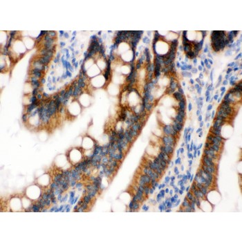 RENT1 / UPF1 Antibody - RENT1/hUPF1 antibody IHC-paraffin. IHC(P): Rat Intestine Tissue.