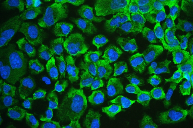 RENT1 / UPF1 Antibody - IF analysis of RENT1/hUPF1 using anti-RENT1/hUPF1 antibody RENT1/hUPF1 was detected in immunocytochemical section of A431 cell. Enzyme antigen retrieval was performed using IHC enzyme antigen retrieval reagent for 15 mins. The tissue section was blocked with 10% goat serum. The tissue section was then incubated with 2µg/mL rabbit anti-RENT1/hUPF1 Antibody overnight at 4°C. DyLight®488 Conjugated Goat Anti-Rabbit IgG was used as secondary antibody at 1:100 dilution and incubated for 30 minutes at 37°C. The section was counterstained with DAPI. Visualize using a fluorescence microscope and filter sets appropriate for the label used.