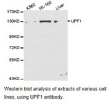 RENT1 / UPF1 Antibody - Western blot.