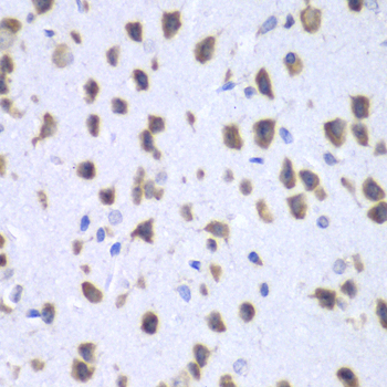 RENT1 / UPF1 Antibody - Immunohistochemistry of paraffin-embedded mouse brain tissue.