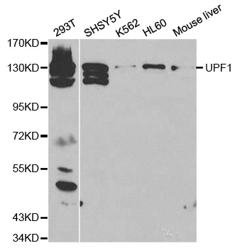 RENT1 / UPF1 Antibody - Western blot analysis of extracts of various cell lines, using UPF1 antibody at 1:500 dilution. The secondary antibody used was an HRP Goat Anti-Rabbit IgG (H+L) at 1:10000 dilution. Lysates were loaded 25ug per lane and 3% nonfat dry milk in TBST was used for blocking.