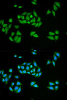 RENT1 / UPF1 Antibody - Immunofluorescence analysis of HeLa cells using UPF1 antibody. Blue: DAPI for nuclear staining.