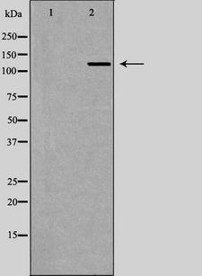 RENT1 / UPF1 Antibody - Western blot analysis of HeLa whole cells lysates using UPF1 antibody. The lane on the left is treated with the antigen-specific peptide.