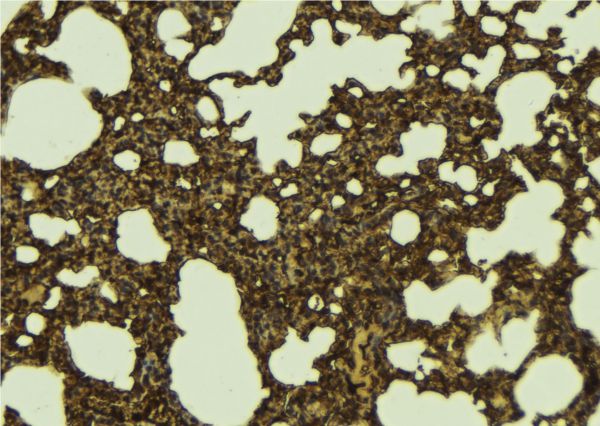 RENT1 / UPF1 Antibody - 1:100 staining mouse lung tissue by IHC-P. The sample was formaldehyde fixed and a heat mediated antigen retrieval step in citrate buffer was performed. The sample was then blocked and incubated with the antibody for 1.5 hours at 22°C. An HRP conjugated goat anti-rabbit antibody was used as the secondary.
