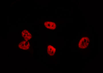 RENT1 / UPF1 Antibody - Staining HeLa cells by IF/ICC. The samples were fixed with PFA and permeabilized in 0.1% Triton X-100, then blocked in 10% serum for 45 min at 25°C. The primary antibody was diluted at 1:200 and incubated with the sample for 1 hour at 37°C. An Alexa Fluor 594 conjugated goat anti-rabbit IgG (H+L) antibody, diluted at 1/600, was used as secondary antibody.