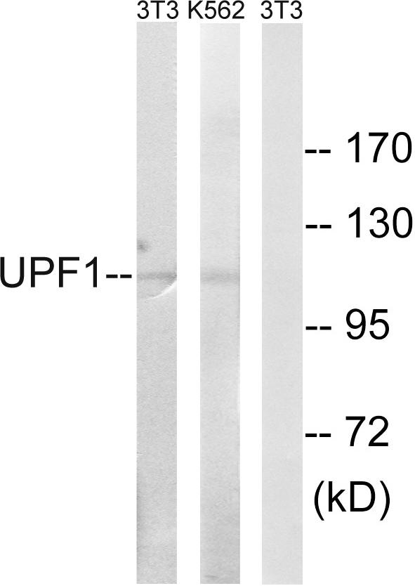 RENT1 / UPF1 Antibody - Western blot analysis of extracts from K562 cells and NIH/3T3 cells, using UPF1 antibody.