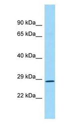 REP15 Antibody - REP15 antibody Western Blot of Fetal Kidney.  This image was taken for the unconjugated form of this product. Other forms have not been tested.