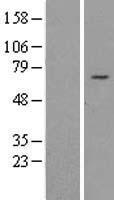 REPIN1 Protein - Western validation with an anti-DDK antibody * L: Control HEK293 lysate R: Over-expression lysate
