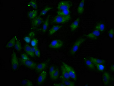 REPS1 Antibody - Immunofluorescence staining of Hela cells at a dilution of 1:166, counter-stained with DAPI. The cells were fixed in 4% formaldehyde, permeabilized using 0.2% Triton X-100 and blocked in 10% normal Goat Serum. The cells were then incubated with the antibody overnight at 4 °C.The secondary antibody was Alexa Fluor 488-congugated AffiniPure Goat Anti-Rabbit IgG (H+L) .