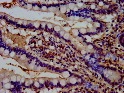 REPS1 Antibody - Immunohistochemistry image at a dilution of 1:500 and staining in paraffin-embedded human small intestine tissue performed on a Leica BondTM system. After dewaxing and hydration, antigen retrieval was mediated by high pressure in a citrate buffer (pH 6.0) . Section was blocked with 10% normal goat serum 30min at RT. Then primary antibody (1% BSA) was incubated at 4 °C overnight. The primary is detected by a biotinylated secondary antibody and visualized using an HRP conjugated SP system.