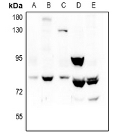 REPS1 Antibody - Western blot analysis of REPS1 expression in A549 (A), LO2 (B), Hela (C), rat testis (D), mouse testis (E) whole cell lysates.