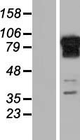 REPS1 Protein - Western validation with an anti-DDK antibody * L: Control HEK293 lysate R: Over-expression lysate