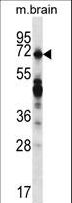 REPS2 Antibody - REPS2 Antibody western blot of mouse brain tissue lysates (35 ug/lane). The REPS2 antibody detected the REPS2 protein (arrow).