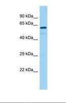 REPS2 Antibody - Western blot of Human 721_B. REPS2 antibody dilution 1.0 ug/ml.  This image was taken for the unconjugated form of this product. Other forms have not been tested.