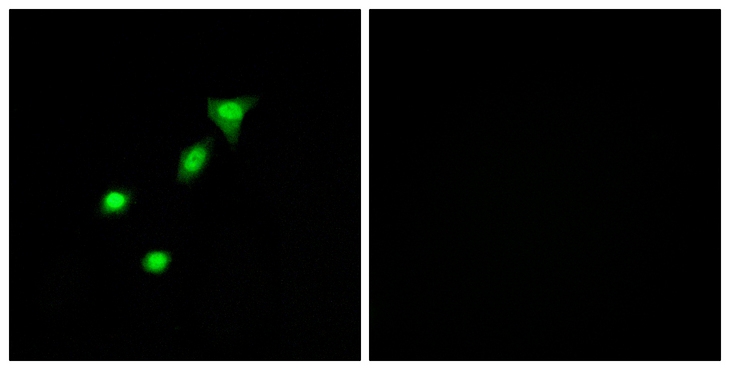Requiem / DPF2 Antibody - Immunofluorescence analysis of A549 cells, using REQU Antibody. The picture on the right is blocked with the synthesized peptide.