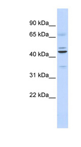 Requiem / DPF2 Antibody - DPF2 antibody Western blot of Fetal Lung lysate. This image was taken for the unconjugated form of this product. Other forms have not been tested.
