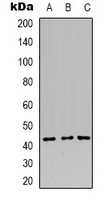 Requiem / DPF2 Antibody - Western blot analysis of DPF2 expression in Jurkat (A); THP1 (B); K562 (C) whole cell lysates.