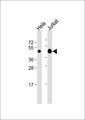 Requiem / DPF2 Antibody - All lanes: Anti-DPF2 Antibody at 1:1000 dilution. Lane 1: HeLa whole cell lysate. Lane 2: Jurkat whole cell lysate Lysates/proteins at 20 ug per lane. Secondary Goat Anti-Rabbit IgG, (H+L), Peroxidase conjugated at 1:10000 dilution. Predicted band size: 44 kDa. Blocking/Dilution buffer: 5% NFDM/TBST.