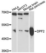 Requiem / DPF2 Antibody - Western blot analysis of extracts of various cell lines, using DPF2 antibody at 1:3000 dilution. The secondary antibody used was an HRP Goat Anti-Rabbit IgG (H+L) at 1:10000 dilution. Lysates were loaded 25ug per lane and 3% nonfat dry milk in TBST was used for blocking. An ECL Kit was used for detection and the exposure time was 90s.