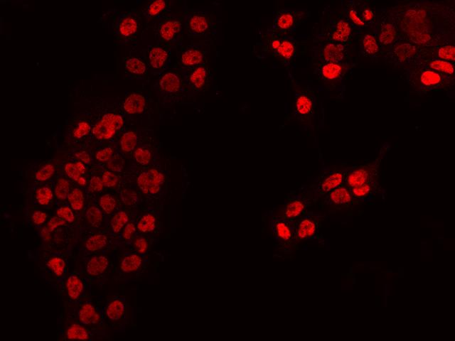 Requiem / DPF2 Antibody - Immunofluorescence staining of DPF2 in A431 cells. Cells were fixed with 4% PFA, permeabilzed with 0.1% Triton X-100 in PBS, blocked with 10% serum, and incubated with rabbit anti-Human DPF2 polyclonal antibody (dilution ratio 1:200) at 4°C overnight. Then cells were stained with the Alexa Fluor 594-conjugated Goat Anti-rabbit IgG secondary antibody (red). Positive staining was localized to Nucleus.