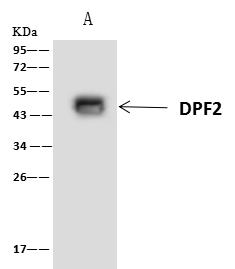 Requiem / DPF2 Antibody - DPF2 was immunoprecipitated using: Lane A: 0.5 mg Jurkat Whole Cell Lysate. 4 uL anti-DPF2 rabbit polyclonal antibody and 60 ug of Immunomagnetic beads Protein A/G. Primary antibody: Anti-DPF2 rabbit polyclonal antibody, at 1:100 dilution. Secondary antibody: Clean-Blot IP Detection Reagent (HRP) at 1:1000 dilution. Developed using the ECL technique. Performed under reducing conditions. Predicted band size: 44 kDa. Observed band size: 44 kDa.