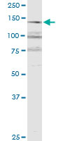 RERE Antibody - RERE monoclonal antibody (M06), clone 2F2. Western Blot analysis of RERE expression in Jurkat.