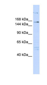 RERE Antibody - RERE antibody Western blot of 293T cell lysate. This image was taken for the unconjugated form of this product. Other forms have not been tested.