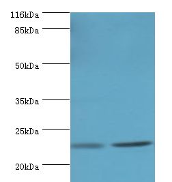 RERG Antibody - Western blot. All lanes: RERG antibody at 2 ug/ml Lane 1:mouse thymus tissue. Lane 2: rat lung tissue. Secondary antibody: Goat polyclonal to rabbit at 1:10000 dilution. Predicted band size: 23 kDa. Observed band size: 23 kDa.  This image was taken for the unconjugated form of this product. Other forms have not been tested.