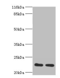 RERG Antibody - Western blot All lanes: RERG antibody at 2µg/ml Lane 1: Mouse thymus tissue Lane 2: Rat lung tissue Secondary Goat polyclonal to rabbit IgG at 1/10000 dilution Predicted band size: 23, 21 kDa Observed band size: 23 kDa