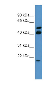 RERG Antibody - RERG antibody Western blot of COLO205 cell lysate.  This image was taken for the unconjugated form of this product. Other forms have not been tested.