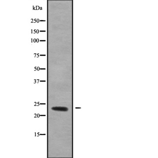 RERG Antibody - Western blot analysis of RERG using HeLa whole cells lysates