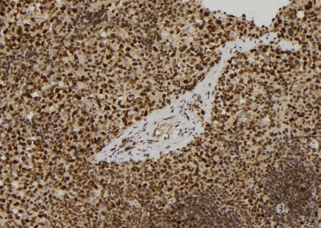 RERG Antibody - 1:100 staining mouse spleen tissue by IHC-P. The sample was formaldehyde fixed and a heat mediated antigen retrieval step in citrate buffer was performed. The sample was then blocked and incubated with the antibody for 1.5 hours at 22°C. An HRP conjugated goat anti-rabbit antibody was used as the secondary.