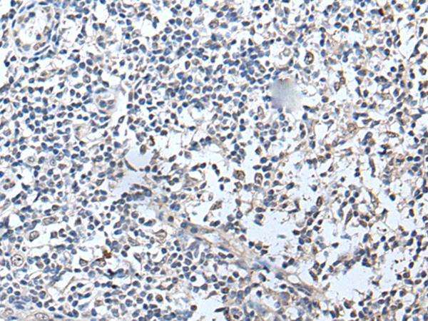 RERG Antibody - Immunohistochemistry of paraffin-embedded Human tonsil tissue  using RERG Polyclonal Antibody at dilution of 1:50(×200)