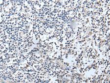 RERG Antibody - Immunohistochemistry of paraffin-embedded Human tonsil tissue  using RERG Polyclonal Antibody at dilution of 1:50(×200)