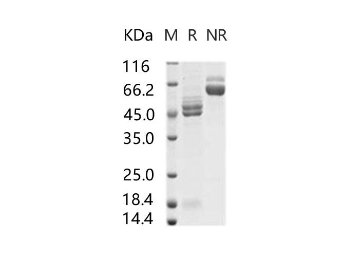 RSV Fusion Glycoprotein Protein - Recombinant RSV (A2) Fusion glycoprotein / RSV-F Protein (His Tag)