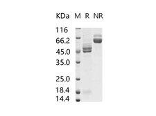 RSV Fusion Glycoprotein Protein - Recombinant RSV (A2) Fusion glycoprotein / RSV-F Protein (His Tag)