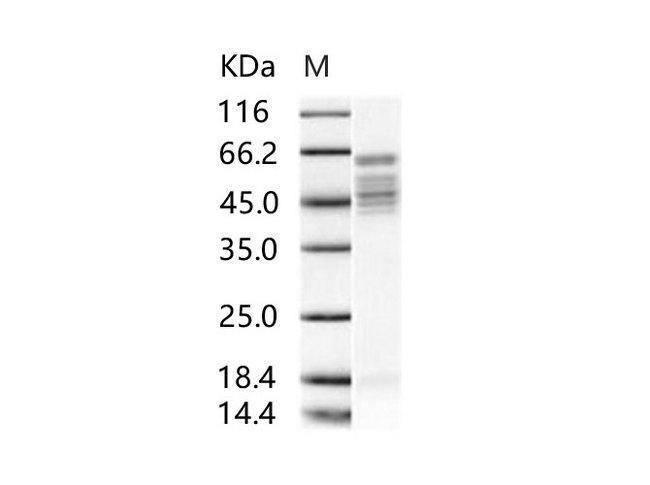 RSV Fusion Protein 1c Protein - Recombinant RSV Fusion protein / RSV-F (Strain RSS-2) Protein (His Tag)