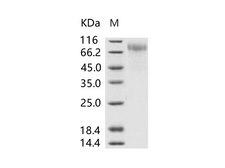RSV Glycoprotein Protein - Recombinant RSV (A, rsb1734) glycoprotein G / RSV-G Protein (95% Homology) (His Tag)