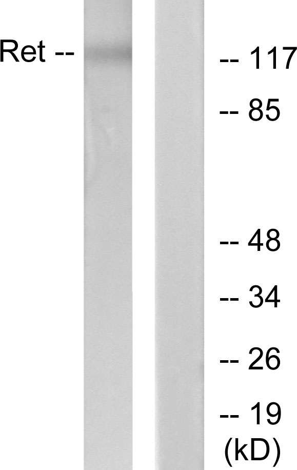 RET Antibody - Western blot analysis of lysates from K562 cells, using Ret Antibody. The lane on the right is blocked with the synthesized peptide.