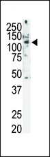 RET Antibody - Western blot of Ret Antibody (C-term T1078) in SKBR3 cell lysate. Ret (arrow) was detected using purified antibody. Secondary HRP-anti-rabbit was used for signal visualization with chemiluminescence.