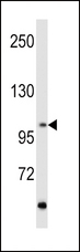 RET Antibody - Western blot of hRET-G28 in MCF7 cell line lysates (35 ug/lane). RET (arrow) was detected using the purified antibody.
