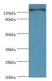 RET Antibody - Western blot. All lanes: RET antibody at 6 ug/ml+HeLa whole cell lysate. Secondary antibody: Goat polyclonal to rabbit at 1:10000 dilution. Predicted band size: 124 kDa. Observed band size: 124 kDa Immunohistochemistry.