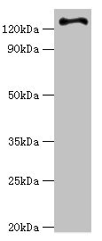 RET Antibody - Western blot All lanes: RET antibody at 6µg/ml + Hela whole cell lysate Secondary Goat polyclonal to rabbit IgG at 1/10000 dilution Predicted band size: 125, 120 kDa Observed band size: 125 kDa