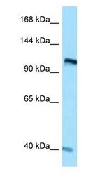 RET Antibody - RET antibody Western Blot of 293T.  This image was taken for the unconjugated form of this product. Other forms have not been tested.